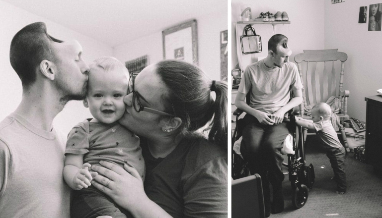 Energy Drinks Almost Kill Husband And Leave Giant Hole In Skull While His Wife Is Pregnant