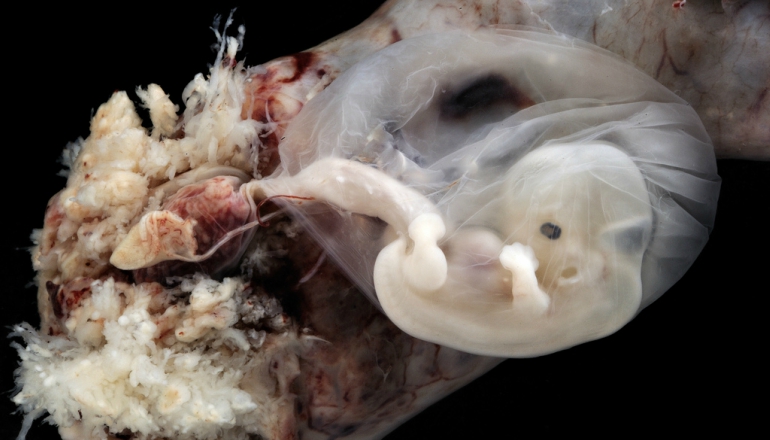 Incredible Real Photos of the Human Developing in the Womb