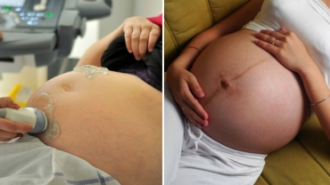 4 Pregnancy-Related Vaginal Infections: What You Need to Know