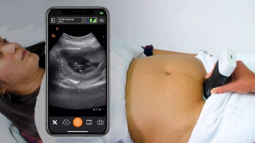 First Trimester Intrauterine Pregnancy: Ultrasound Scanning Technique