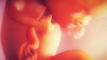 Duodenal Atresia Repair for Newborn Baby
