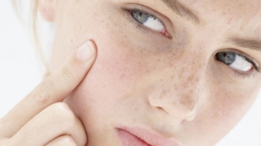 How to Clear up Acne While Pregnant 