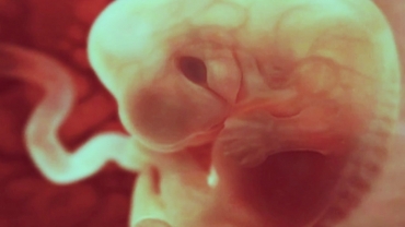 How Your Baby Takes Shape?