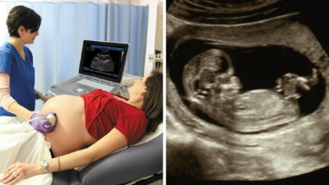 Is it a Boy or Girl: 8 Common Gender Prediction Methods