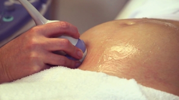 What is a Nuchal Translucency Examination?