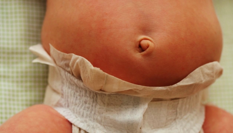 How to Care for Newborn's Belly Button