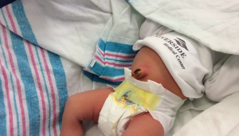 How to Clean Baby's Umbilical Cord?