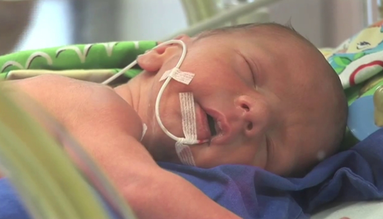 The Premature Baby: Growth and Development