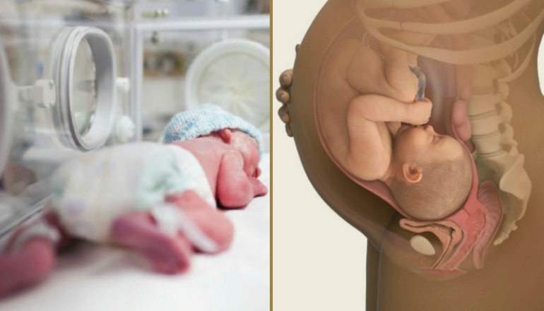 Understanding Infant Brain Injuries at Birth