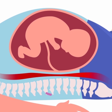 Safe and Comfortable Sleeping Positions During Pregnancy