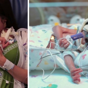 A Mother’s Love: Premature Baby Was Born 3 Months Early