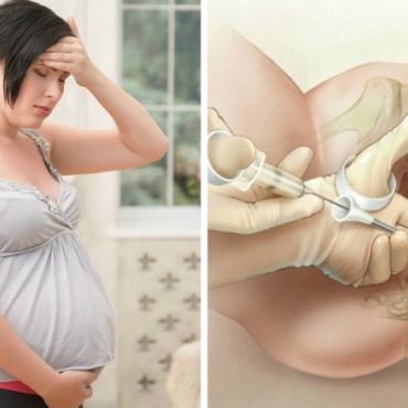 Different Pain Relief Options During Labour and Birth