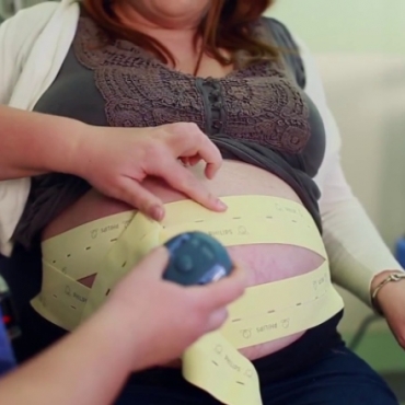 Fetal Monitoring During Labor (VBAC)