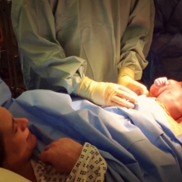 Natural Caesarean: A Baby Delivering Itself During a C-Section