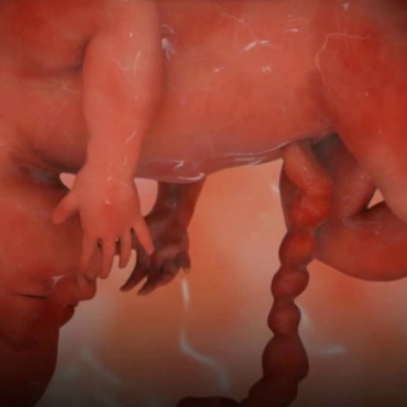 Pregnancy Week 32 - Eight Months Pregnant