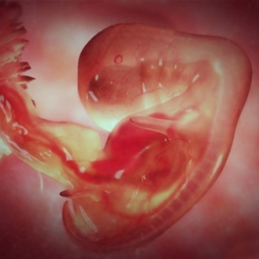 Pregnancy Week 5 - Two Months Pregnant