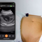 First Trimester Intrauterine Pregnancy: Ultrasound Scanning Technique