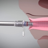 Diva Laser Vaginal Therapy